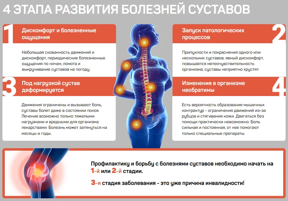4 этапа развития болезней суставов у челочека