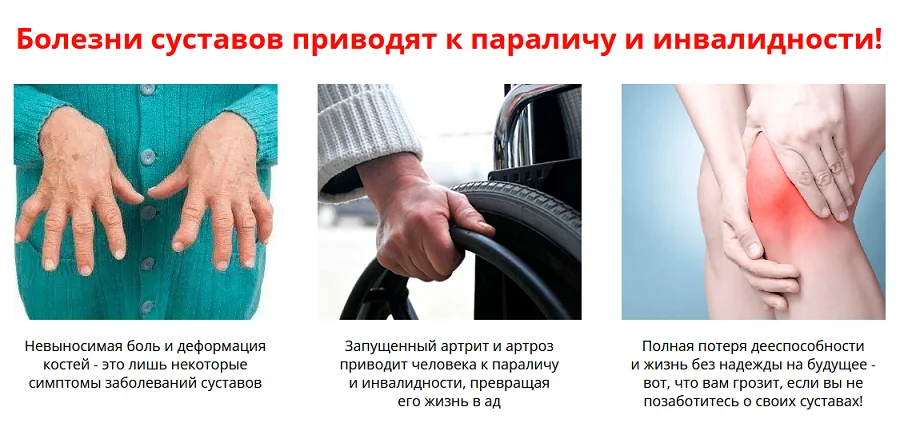 Болезни суставов приводят к параличу и инвалидности