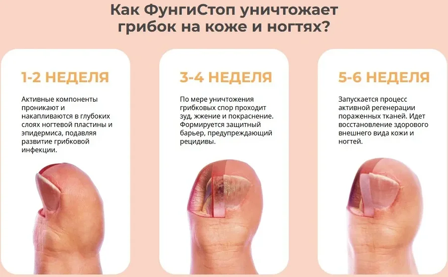 Как препарат ФунгиСтоп уничтожает грибок на коже и ногтях