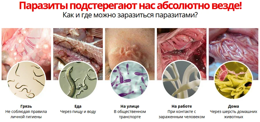 Как и где можно заразиться паразитами