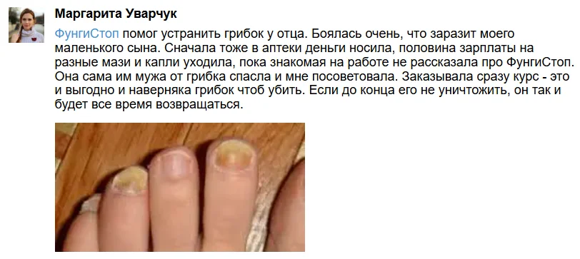 Отзыв реального покупателя о препарате ФунгиСтоп от грибка ногтей на ногах №1