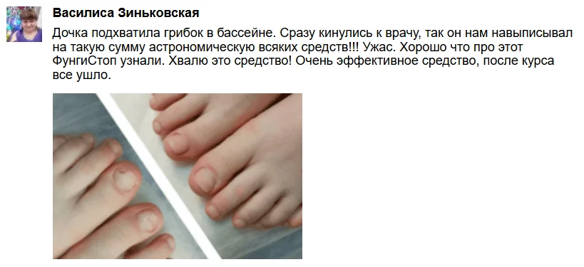 Отзыв реального покупателя о препарате ФунгиСтоп от грибка ногтей на ногах №3