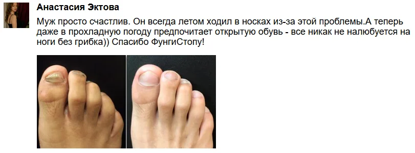 Отзыв реального покупателя о препарате ФунгиСтоп от грибка ногтей на ногах №8