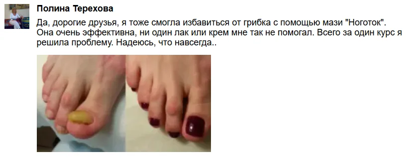 Отзыв покупателя о мази Ноготок от грибка ногтей №3