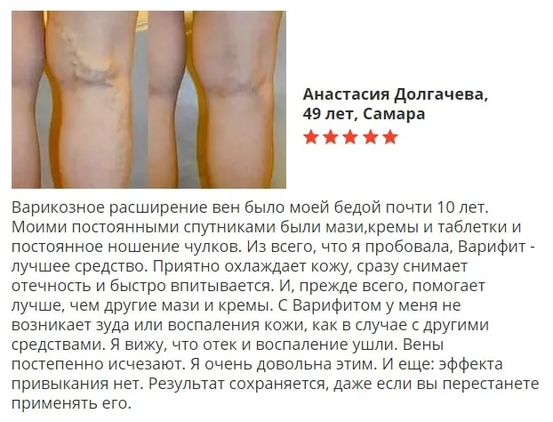 Отзыв покупателя о препарате Варифит гель от варикоза №4