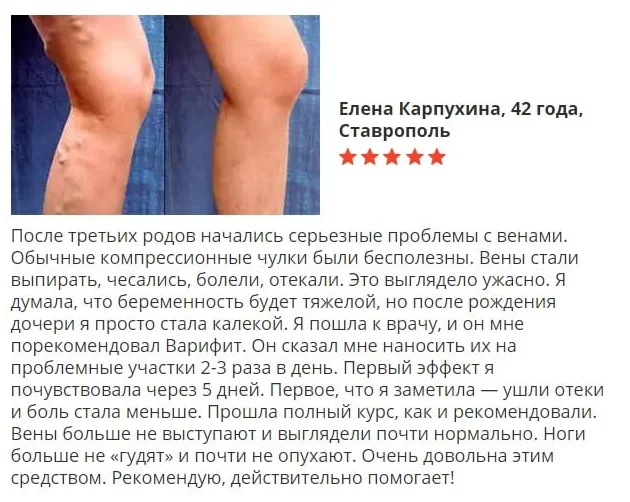 Отзыв покупателя о препарате Варифит гель от варикоза №6