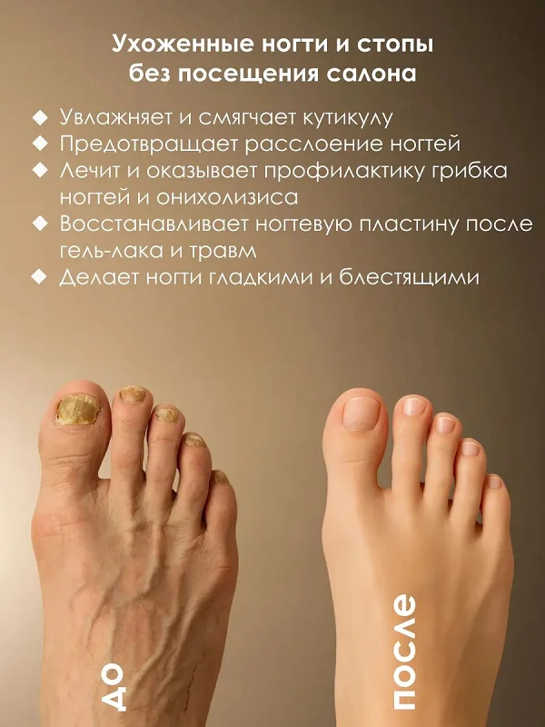 Преимущества препарата ФунгиСтоп от грибка ногтей на ногах