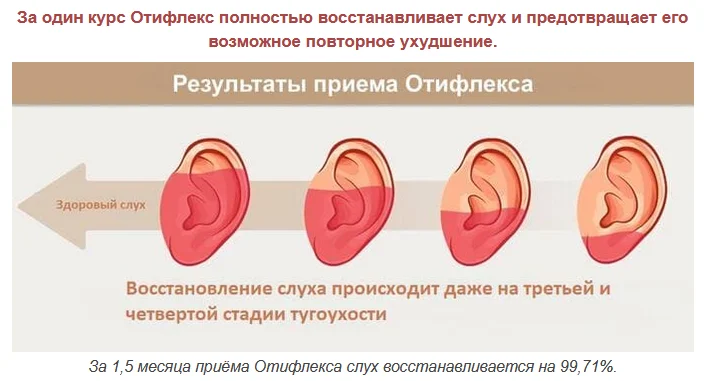 Результаты приема препарата Отифлекс для улучшения слуха за период полтора месяца
