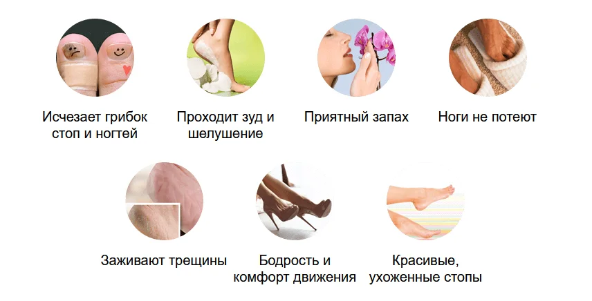 Эффект после 30 дней применению Миценил крема от грибка ногтей на ногах, коже и стопах
