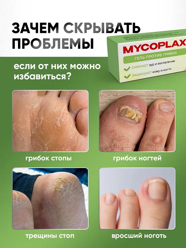 Показания к применению препарата Mycoplax (Микоплакс) геля от грибка