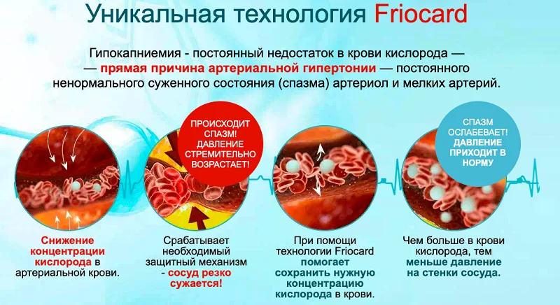 В препарате Кардинео используется уникальная технология Friocard