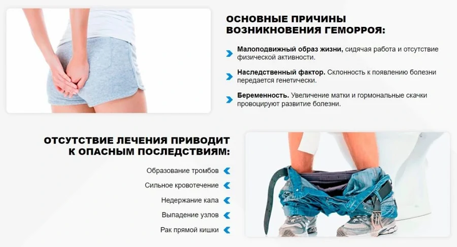 Основные причины возникновения геморроя и опасные последствия нелечения данного заболевания