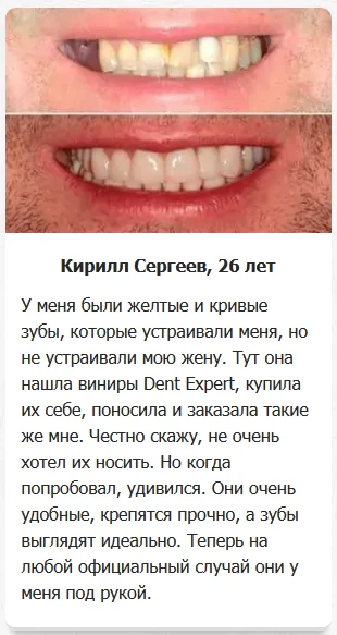 Отзыв реального покупателя о Dent Expert (Дент Эксперт) виниры для зубов №1