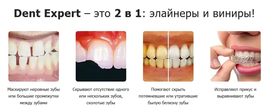 Виниры Dent Expert это 2 в 1: элайнеры и виниры!