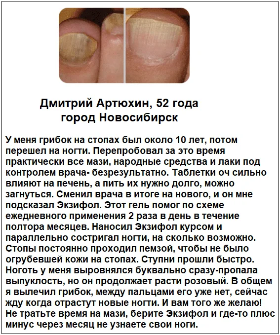 Отзывы реальных покупателей и пациентов о препарате Экзифол гель от грибка ногтей №4