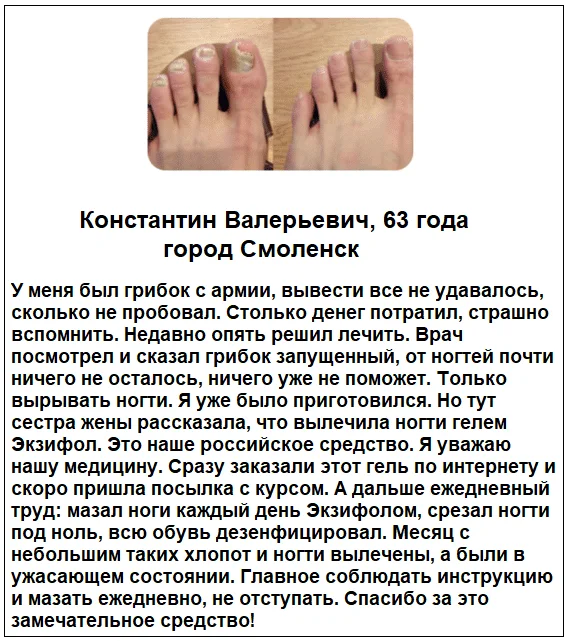 Отзывы реальных покупателей и пациентов о препарате Экзифол гель от грибка ногтей №5
