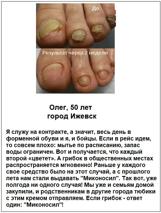 Отзывы реальных покупателей о препарате Миконосил Меридиан крем от грибка ногтей №4