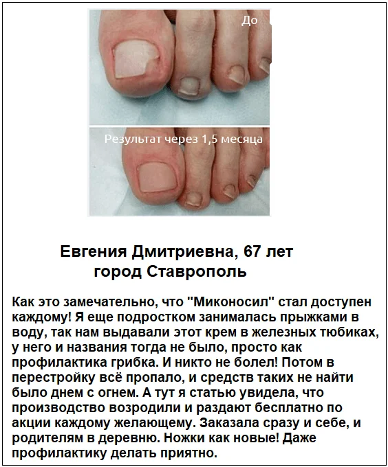 Отзывы реальных покупателей о препарате Миконосил Меридиан крем от грибка ногтей №5