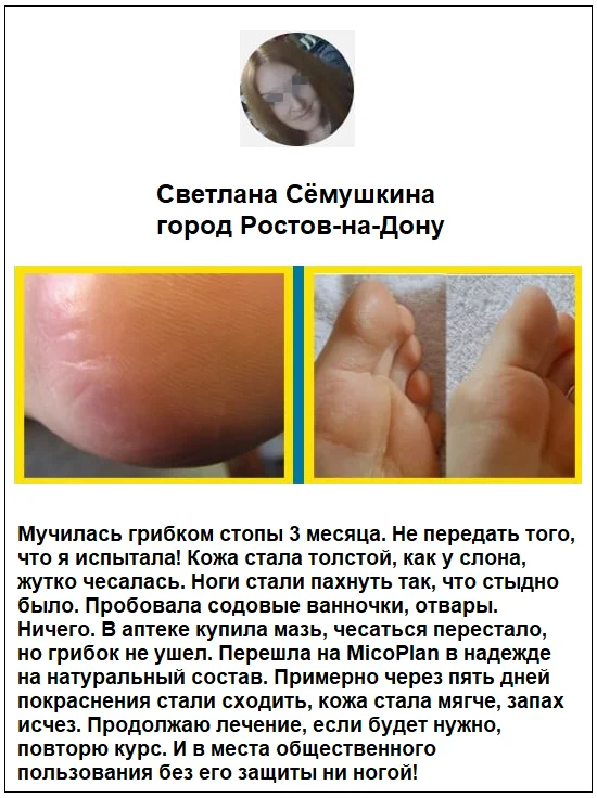 Отзывы реальных покупателей о препарате Микоплан от грибка ногтей №7