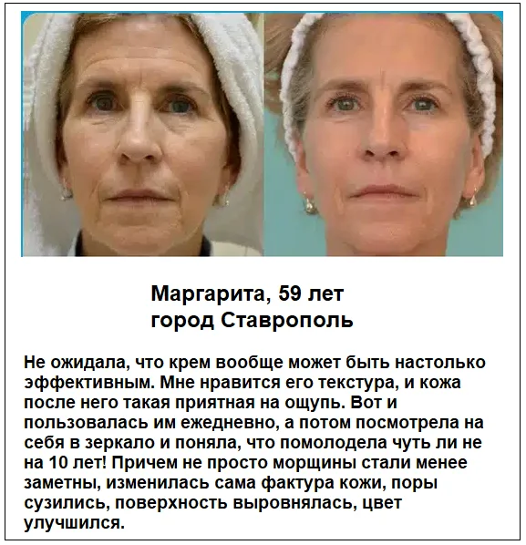 Отзывы реальных покупателей о средстве Night Miracle омолаживающий крем для лица с ботоксом №4