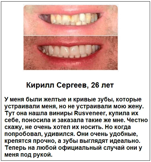 Отзывы реальных покупателей о товаре Rusveneer виниры съемные для зубов №5