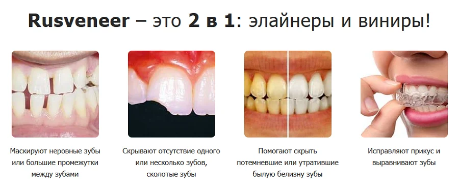 Показания к применению Rusveneer виниры для зубов