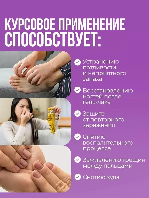 Преимущества геля Экзифол от грибка ногтей