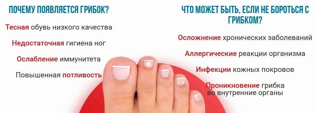Преимущества крема от грибка Микоплан