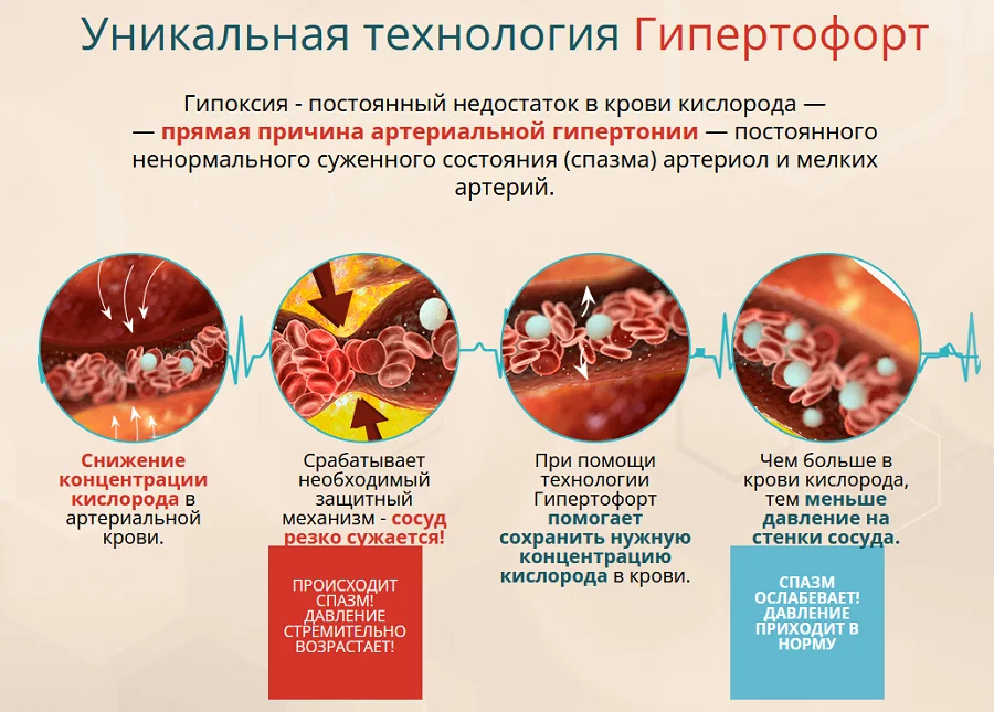 Препарат Гипертофорт от давления обладает уникальной технологией