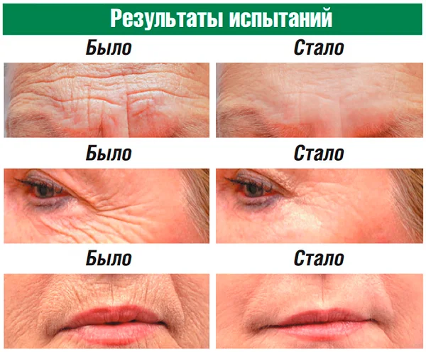 Результаты испытаний омолаживающего крема для лица Night Miracle (Найт Миракл)