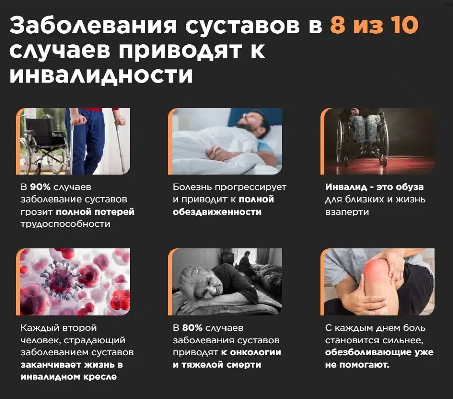 Заболевания суставов в 8 из 10 случаев приводят к инвалидности