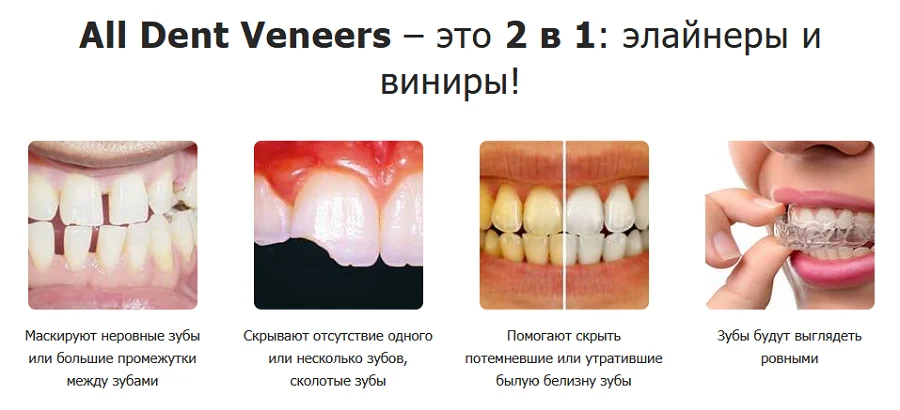 Преимущества съемных винир для зубов All Dent Veneers