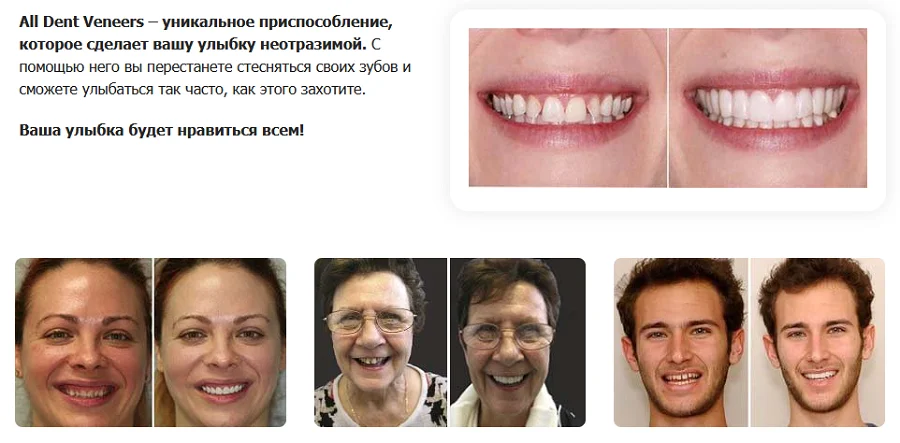 All Dent Veneers уникальное приспособление, которое сделает Вашу улыбку неотразимой!