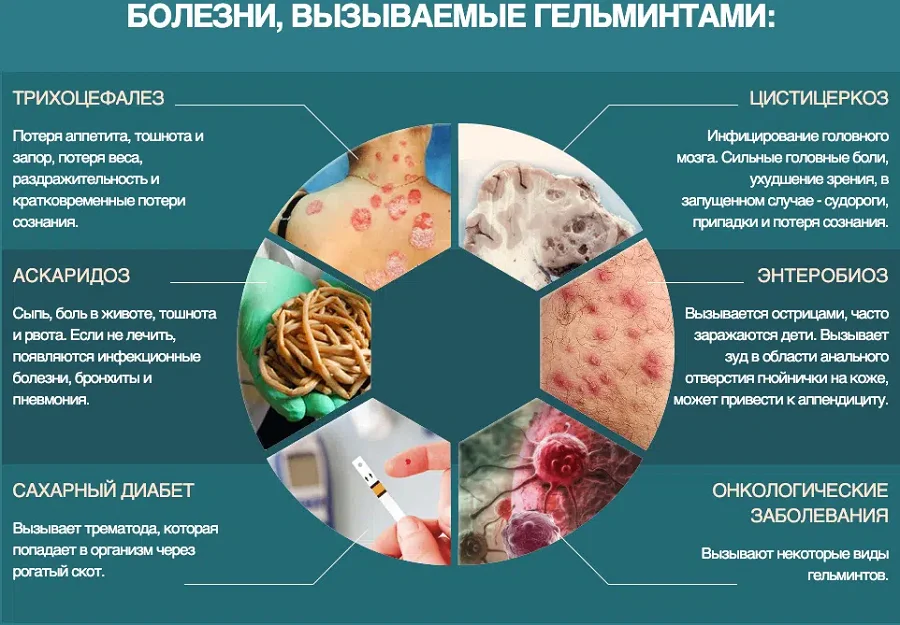 Болезни, вызываемые гельминтами