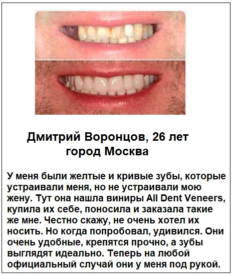 Отзывы реальных покупателей о товаре All Dent Veneers съемные виниры для зубов №1