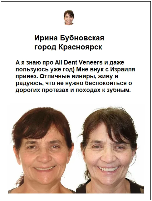 Отзывы реальных покупателей о товаре All Dent Veneers съемные виниры для зубов №4