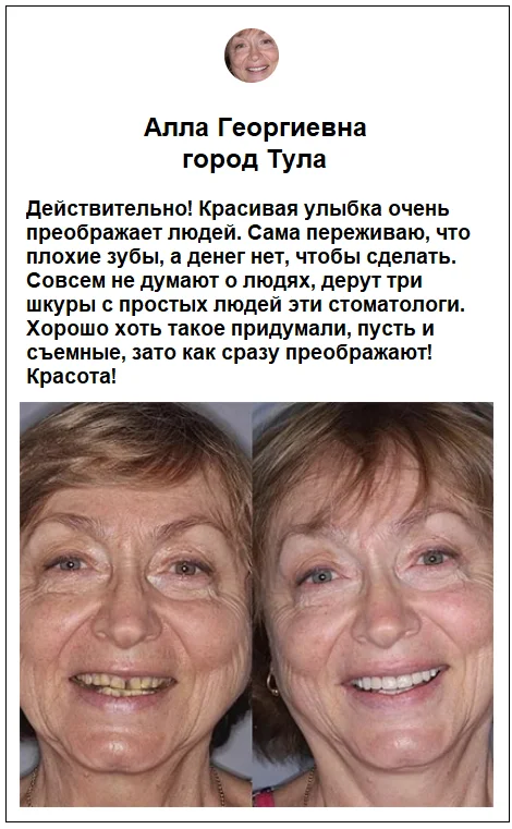 Отзывы реальных покупателей о товаре All Dent Veneers съемные виниры для зубов №5