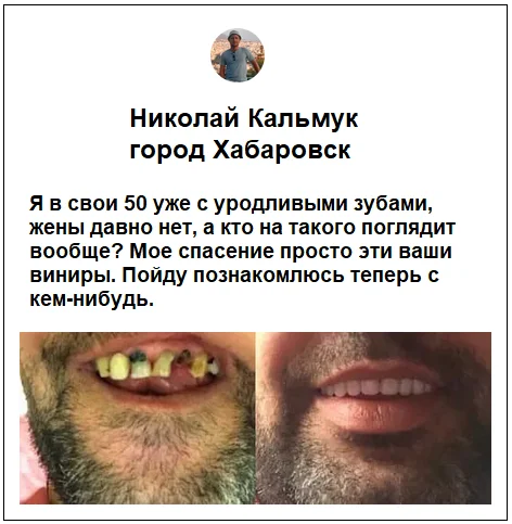 Отзывы реальных покупателей о товаре All Dent Veneers съемные виниры для зубов №6