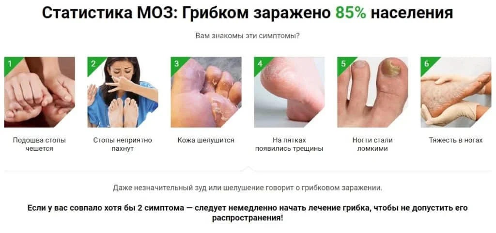 Статистика МОЗ: Грибком заражено 85% населения